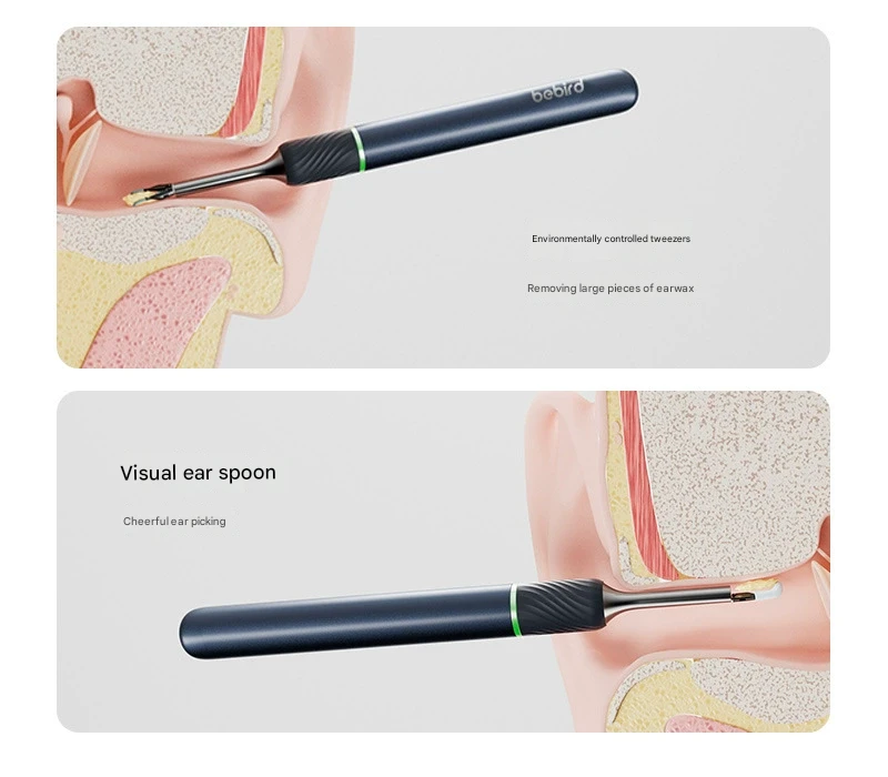 Dark blue Hlpmedical Smart Visual Ear Cleaner with HD endoscope and precision tweezers for safe ear cleaning for adults and children.