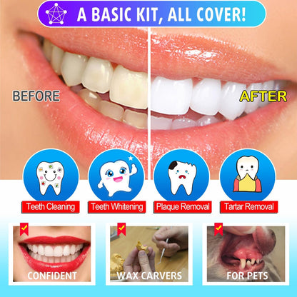 Dental Tools, Dental Pick Teeth Cleaning Tools Hygiene Kit, Plaque Remover for Teeth, Professional Stainless Steel Tooth Scraper Plaque Tartar Cleaner - with Case