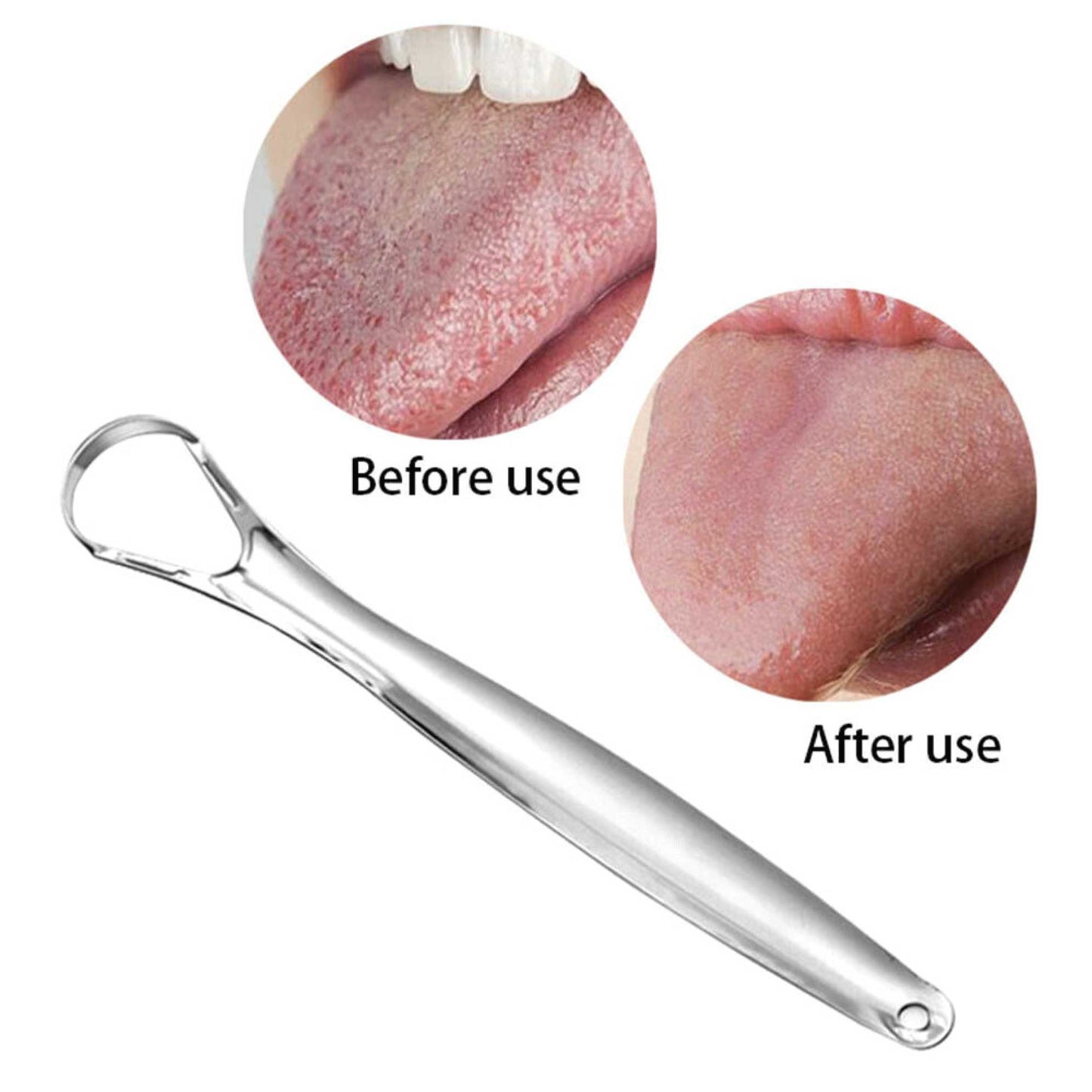 Hlpmedical stainless steel tongue scraper for oral hygiene and bad breath reduction, displayed on a clean white background.