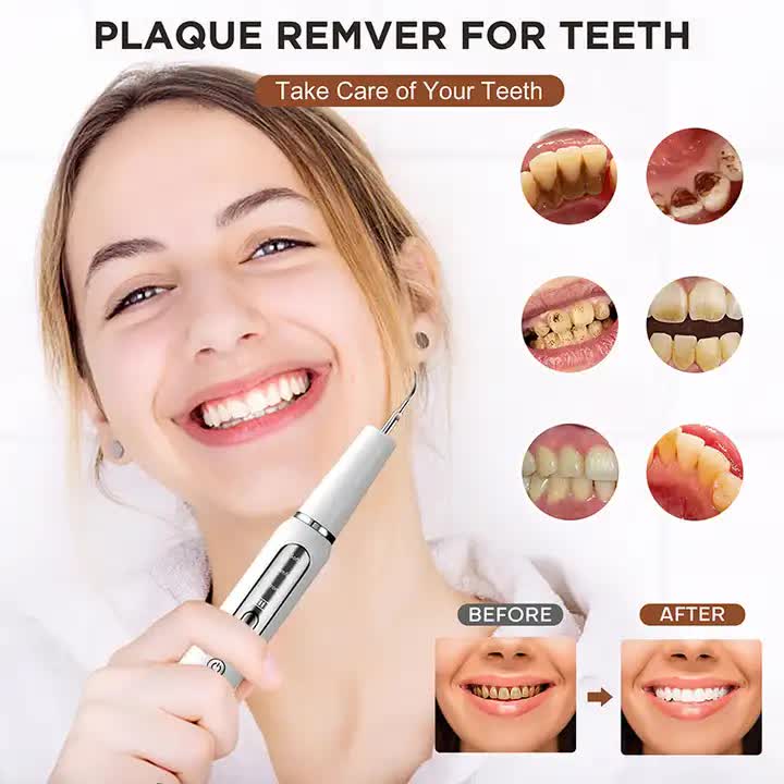 Black portable ultrasonic dental cleaner by Hlpmedical for home use, removes plaque, stains, and tartar from teeth.