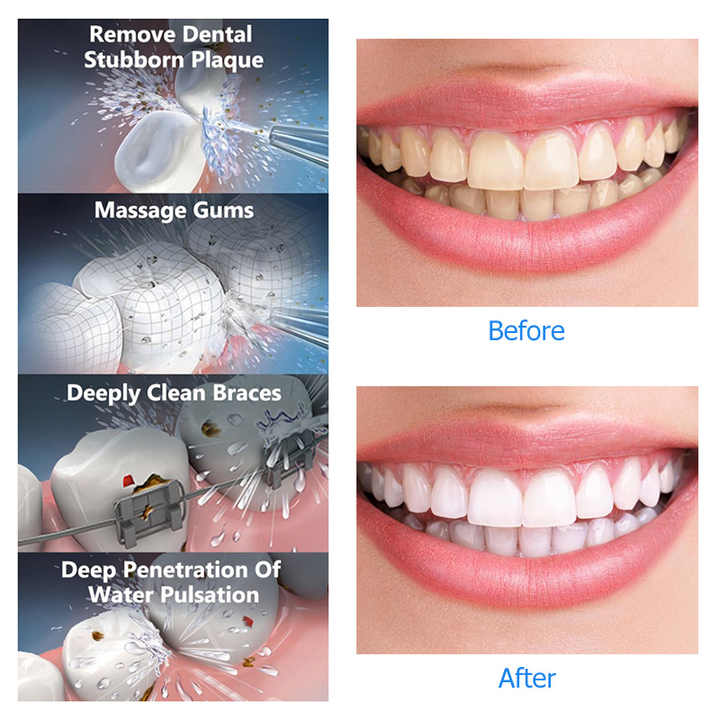 Black Hlpmedical portable water flosser with four cleaning modes, rechargeable, waterproof oral irrigator for deep dental care.