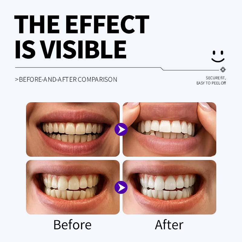 Hlpmedical enamel-safe teeth whitening strips with antibacterial gum care, shown on a white background, 12 strips per pack.