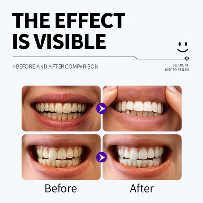 Hlpmedical enamel-safe teeth whitening strips with antibacterial gum care, shown on a white background, 12 strips per pack.