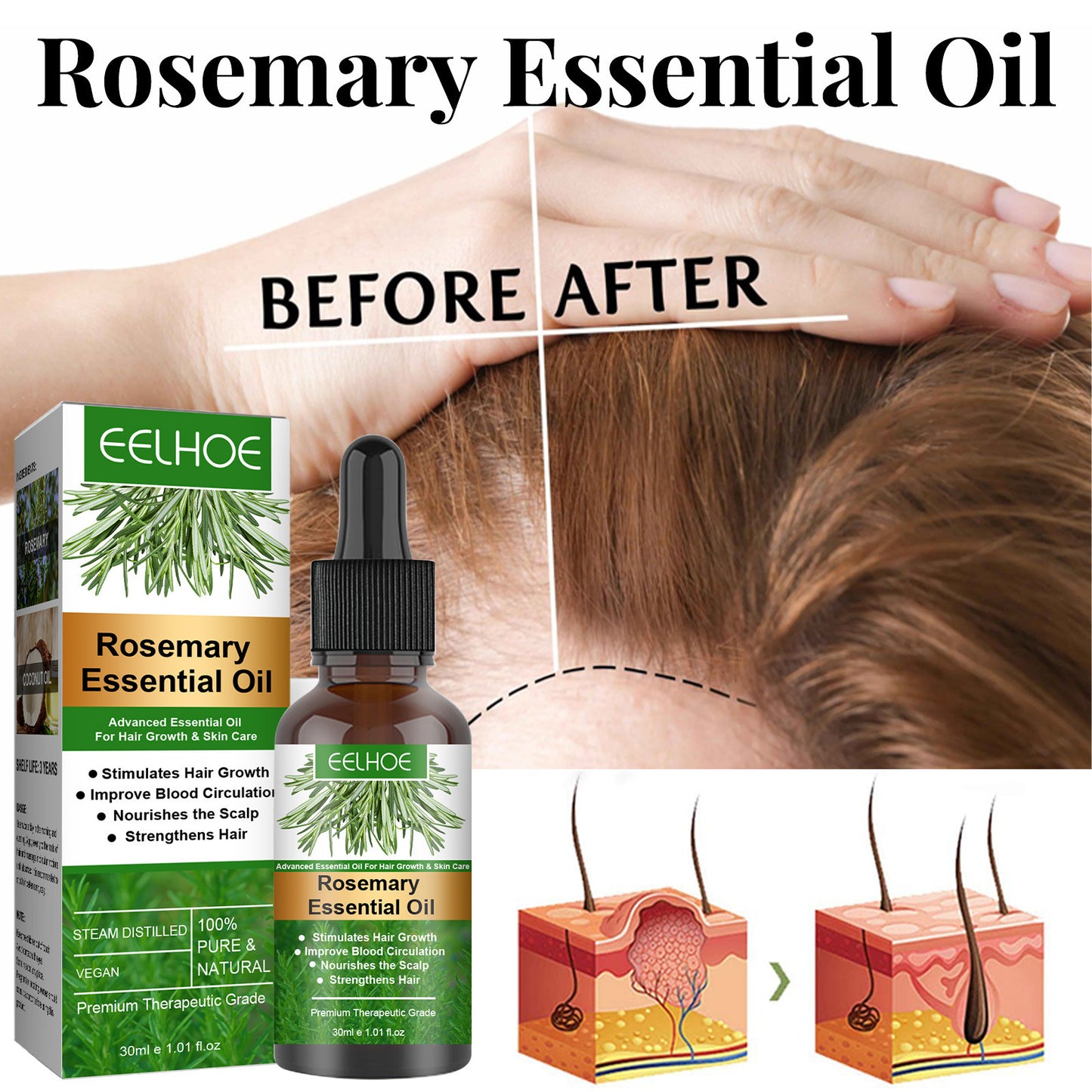 Rosemary anti-breakage nourishing hair care oil in a 30ml bottle by HLP Medical Supplies, designed to strengthen hair and reduce breakage.